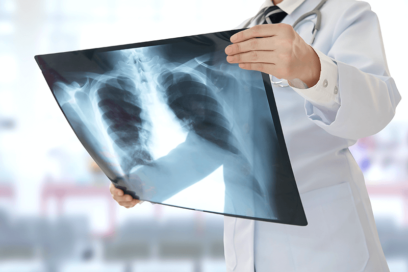 Рентген легких в Москве — клиники, цены, отзывы, адреса медицинских центров